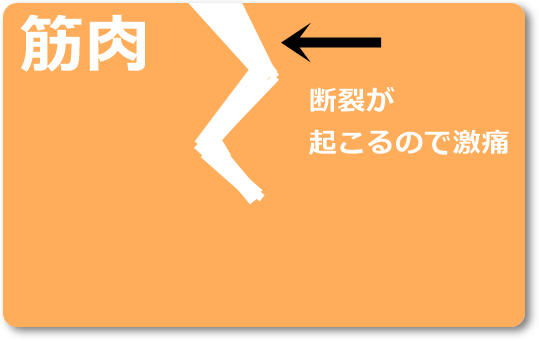 首の寝違えについて。もし急な首の寝ちがえになったらこうしよう!