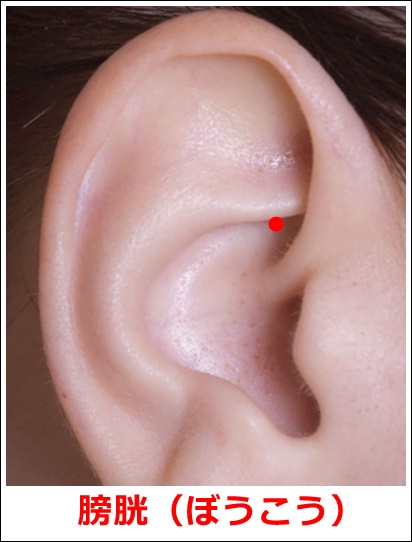 排尿障害の耳ツボ