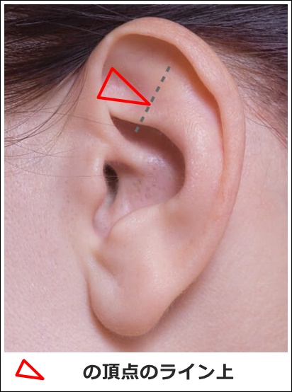 耳ツボ腎1