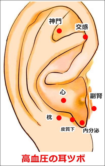 高血圧の耳ツボ画像