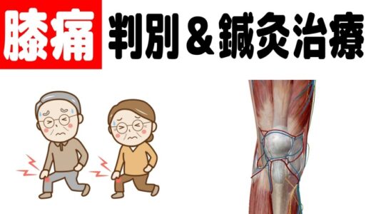 膝痛の判別＆治療法