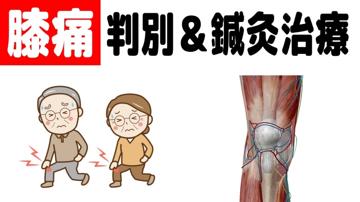 膝痛 判別＆鍼灸治療