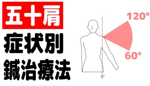 五十肩（肩関節周囲炎）の中国鍼による治療ポイント