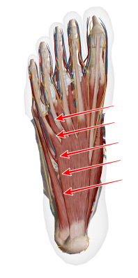 足底筋の刺鍼方法
