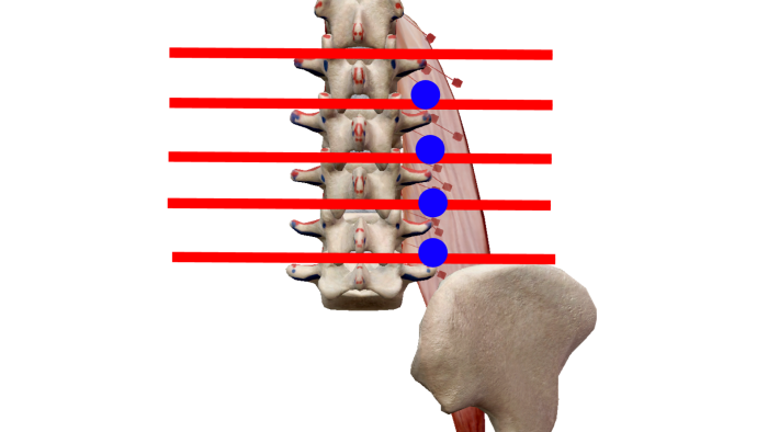 大腰筋刺鍼の位置
