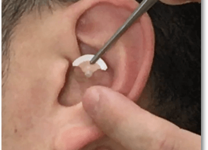 耳ツボを自分でするやり方（動画あり）