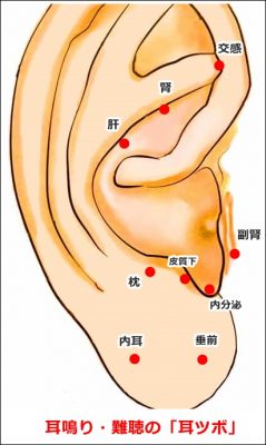 耳鳴り 難聴の 耳ツボ 図解 鍼灸師監修